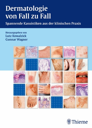 Dermatologie von Fall zu Fall