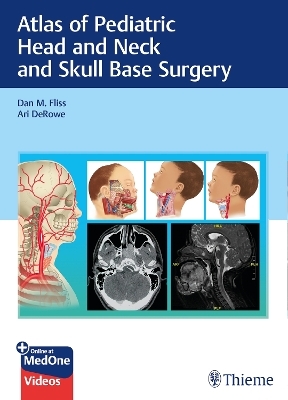 Atlas of Pediatric Head and Neck and Skull Base Surgery - 