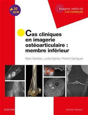Cas cliniques en imagerie ost&eacute;oarticulaire : membre inf&eacute;rieur - Marc Garetier, Lucile Deloire, F. Garrigues
