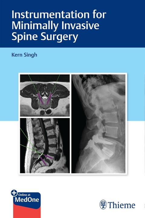 Instrumentation for Minimally Invasive Spine Surgery - Kern Singh