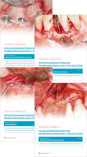 Entscheidungskriterien bei Neubehandlungen nach Fehlschl&auml;gen - Giorgio Tabanella