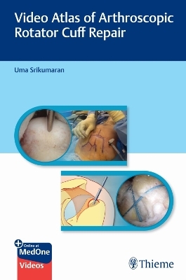 Video Atlas of Arthroscopic Rotator Cuff Repair - Uma Srikumaran