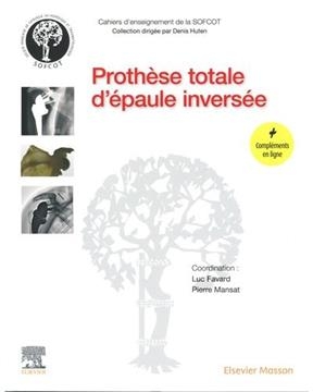 Proth&egrave;se totale d'&eacute;paule invers&eacute;e