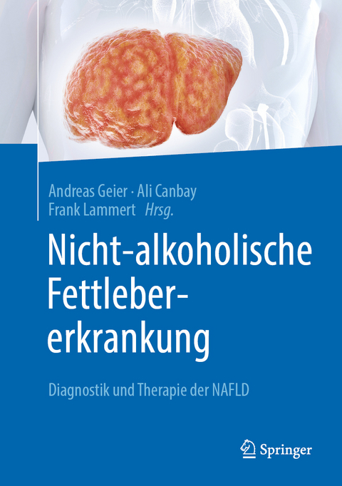 Nicht-alkoholische Fettlebererkrankung - 