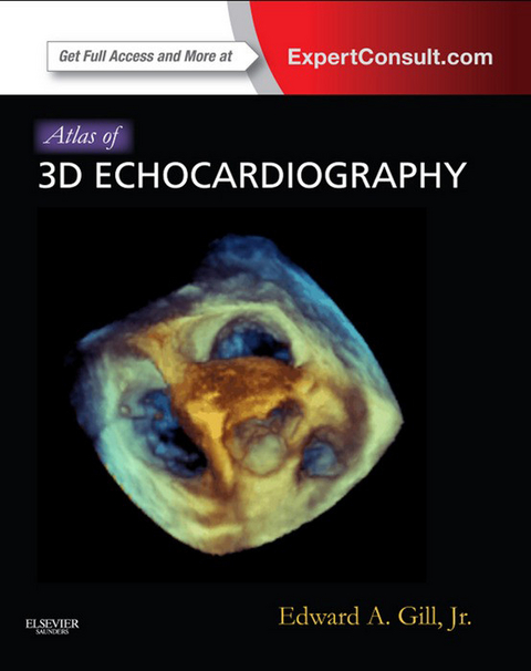 Atlas of 3D Echocardiography E-Book -  Edward A. Gill