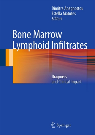Bone Marrow Lymphoid Infiltrates