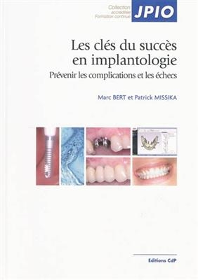 Les clés du succès en implantologie : prévenir les complications et les échecs