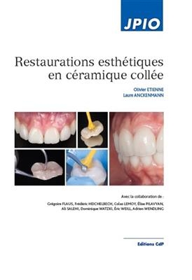 RESTAURATIONS ESTHETIQUES EN CERAMIQUE C