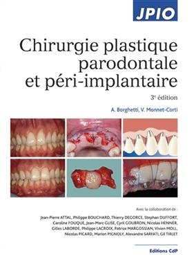 Chirurgie plastique parodontale et p&eacute;ri-implantaire - Alain Borghetti, Virginie Monnet-Corti