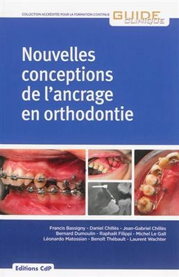 Nouvelles conceptions de l'ancrage en orthodontie -  BASSIGNY F