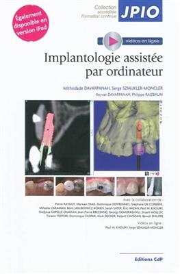 Implantologie assist&eacute;e par ordinateur -  DAVARPANAH/SZMU