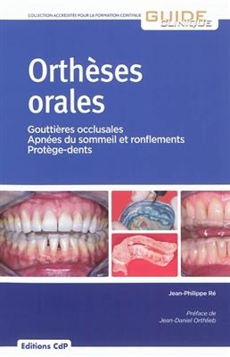Orthèses orales : gouttières occlusales, apnées du sommeil et ronflements, protège-dents