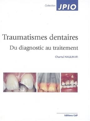 TRAUMATISMES DENTAIRES -  NAULIN IFI CHANTAL