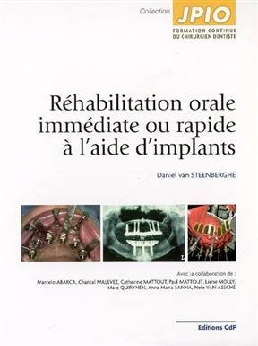 R&eacute;habilitation orale imm&eacute;diate ou rapide &agrave; l'aide d'implants - Daniel Van Steenberghe