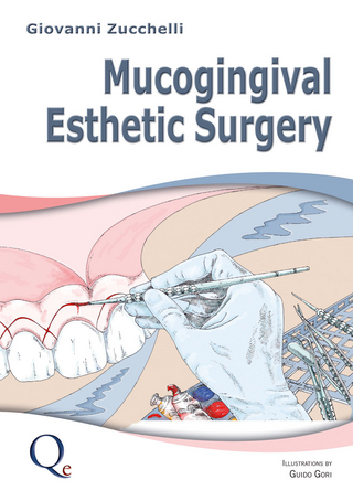 Mucogingival Esthetic Surgery