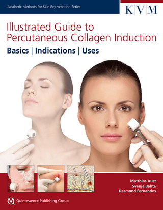 Illustrated Guide to Percutaneous Collagen Induction: Basics, Indications, Uses
