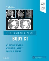Fundamentals of Body CT - W. Richard Webb, Wiliam E. Brant, Nancy M. Major