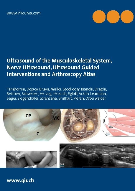 Ultrasound of the Musculoskeletal System, Nerve Ultrasound, Ultrasound Guided Interventions and Arthroscopy Atlas - Giorgio Tamborrini, Christian Dejaco George A.W. Bruyn, Lisa Reissner Andreas Schweizer, Andreas A. M. M&uuml;ller Sebastian A. M&uuml;ller, Richard F. Herzog Floreana Kebaish, Christian Egloff Yves Acklin, Andr&eacute; Leumann Michael Sager, Andreas Siegenthaler David Lorenzana, Laure Brulhart Amara Pieren