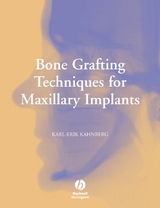 Bone Grafting Techniques for Maxillary Implants - Karl-Erik Kahnberg