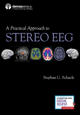 A Practical Approach to Stereo EEG - 