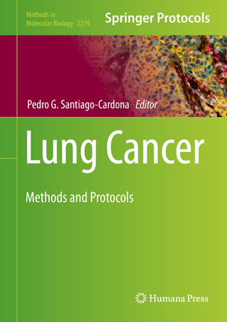 Lung Cancer