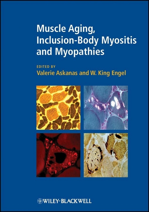 Muscle Aging, Inclusion-Body Myositis and Myopathies - 
