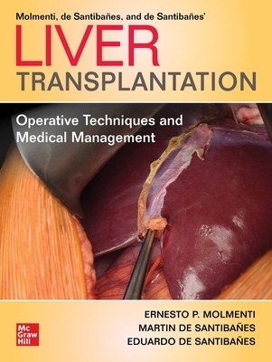 Liver Transplantation: Operative Techniques and Medical Management - Ernesto P. Molmenti, Martin de Santiba&ntilde;es, Eduardo de Santiba&ntilde;es