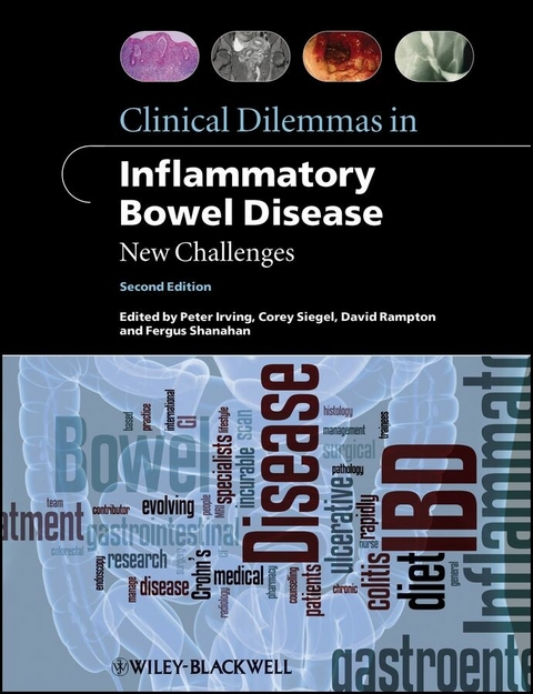 Clinical Dilemmas in Inflammatory Bowel Disease - 