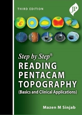 Step by Step: Reading Pentacam Topography - Mazen M Sinjab