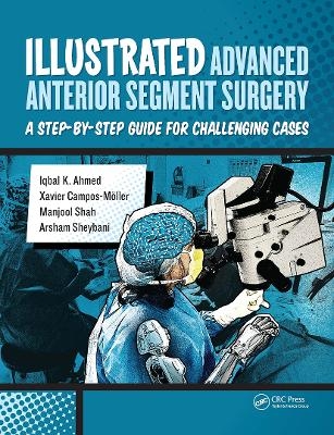 Illustrated Advanced Anterior Segment Surgery