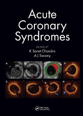 Acute Coronary Syndromes