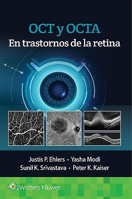 OCT y OCTA en trastornos de la retina - Justis P. Ehlers