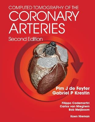 Computed Tomography of the Coronary Arteries
