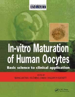 In Vitro Maturation of Human Oocytes