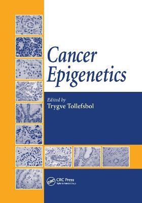 Cancer Epigenetics