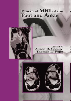 Practical MRI of the Foot and Ankle - 