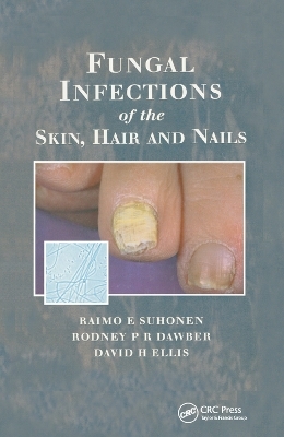 Fungal Infections of the Skin and Nails - Raimo E. Suhonen, Rodney P.R. Dawber, David H. Ellis
