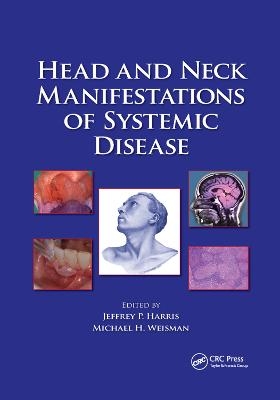 Head and Neck Manifestations of Systemic Disease