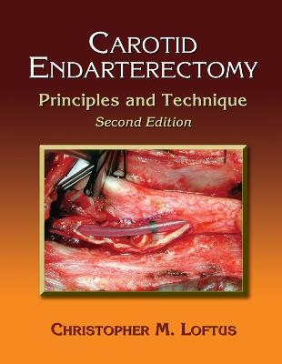 Carotid Endarterectomy