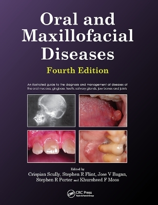 Oral and Maxillofacial Diseases - Crispian Scully, Stephen Flint, Kursheed Moos, Jose Bagan