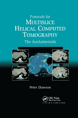 Protocols for Multislice Helical Computed Tomography - DAWSON PETER