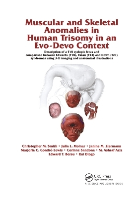 Muscular and Skeletal Anomalies in Human Trisomy in an Evo-Devo Context - Rui Diogo, Christopher M. Smith, Janine M. Ziermann, Julia Molnar, Marjorie C. Gondre-Lewis