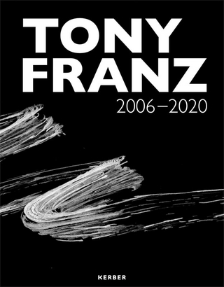 Tony Franz