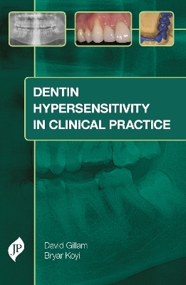 Dentin Hypersensitivity in Clinical Practice