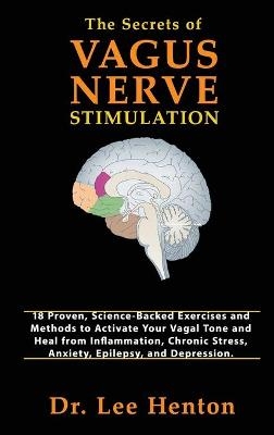 The Secrets of Vagus Nerve Stimulation - Dr Lee Henton