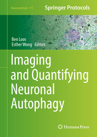 Imaging and Quantifying Neuronal Autophagy
