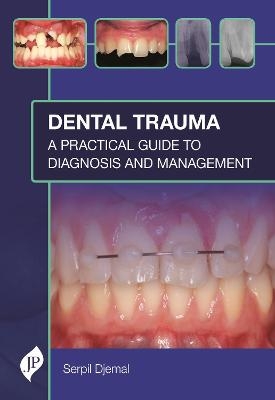 Dental Trauma - Serpil Djemal