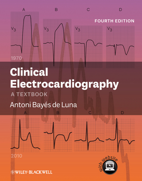 Clinical Electrocardiography - Antoni Bay&eacute;s de Luna