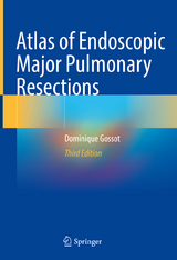 Atlas of Endoscopic Major Pulmonary Resections - Gossot, Dominique
