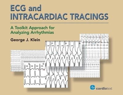 ECG and Intracardiac Tracings - George J Klein